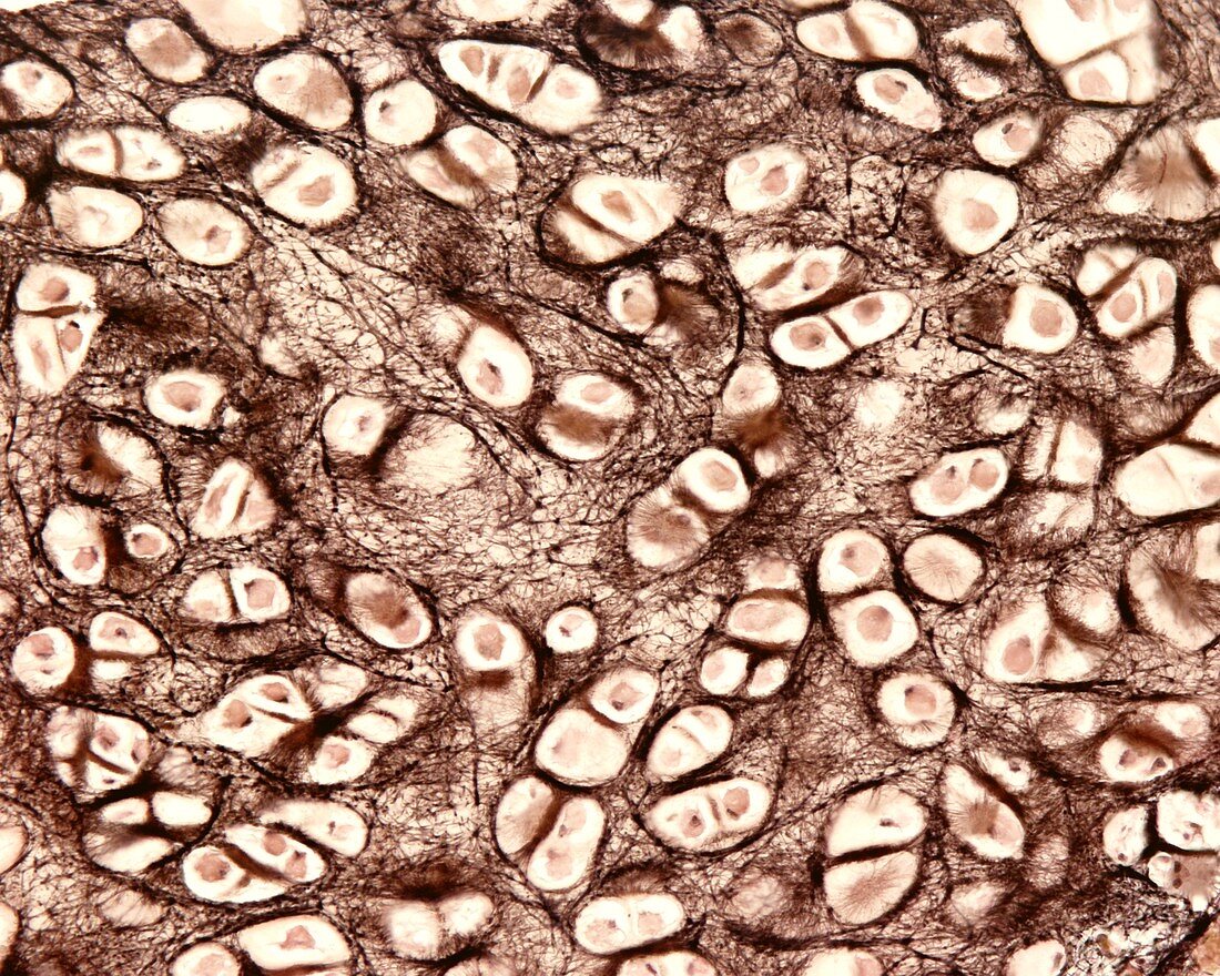 Elastic cartilage, light micrograph