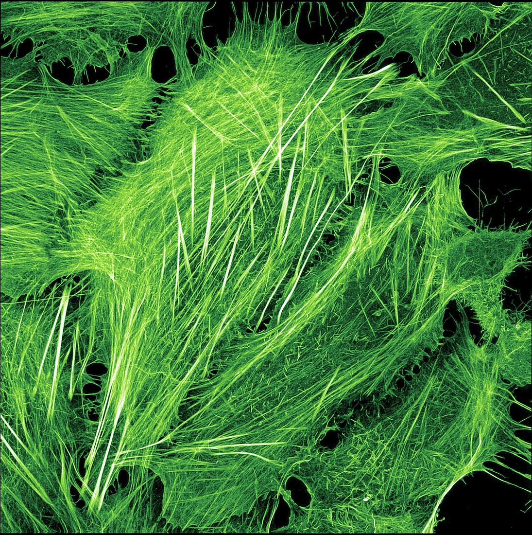 Bone cancer cell showing cytoskeleton, light micrograph