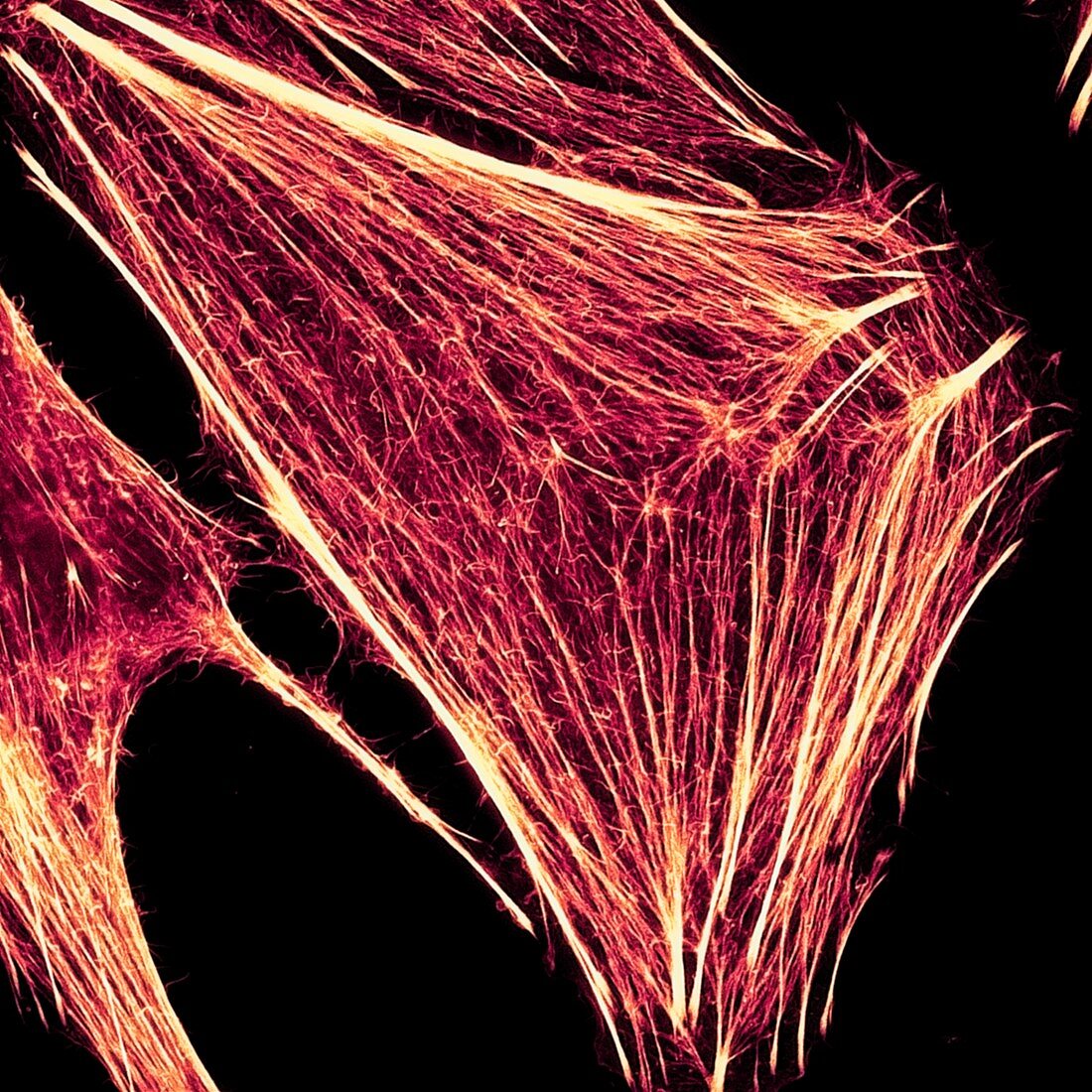 Cancer cell super resolution cytoskeleton, light micrograph