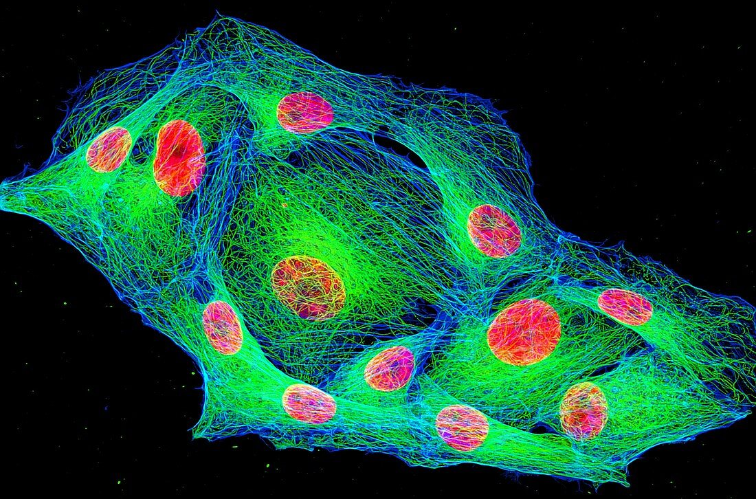 Osteosarcoma cytoskeleton and nuclei, light micrograph