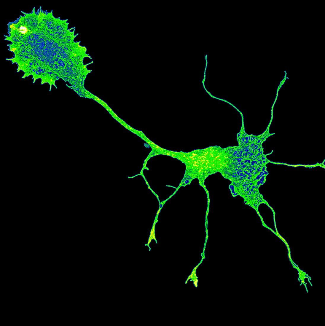 Single brain cell showing cytoskeleton, light micrograph