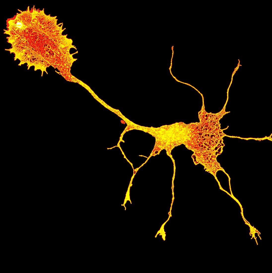 Single cortical neuron, light micrograph