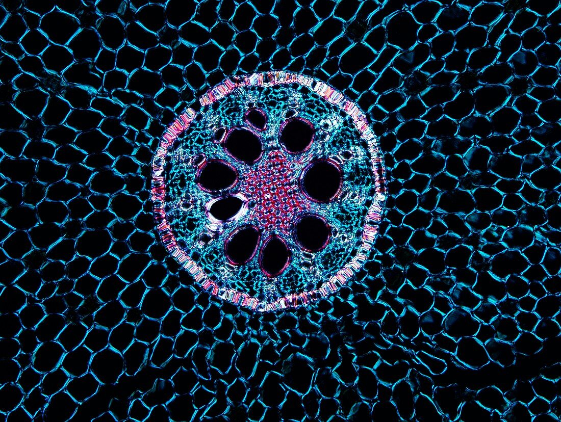 Iris root, polarised light micrograph