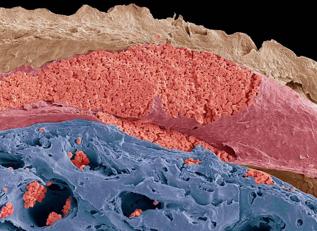 Vein of the scalp, SEM