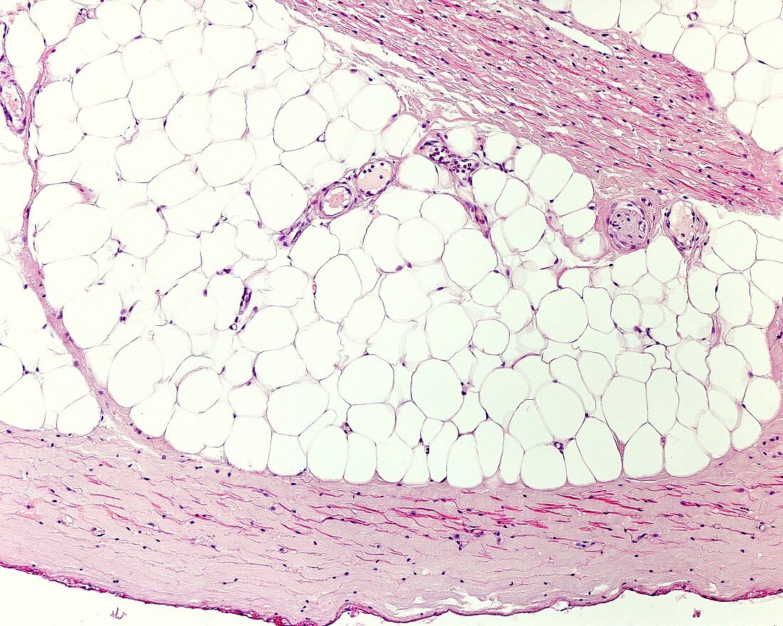 Adipose tissue, light micrograph
