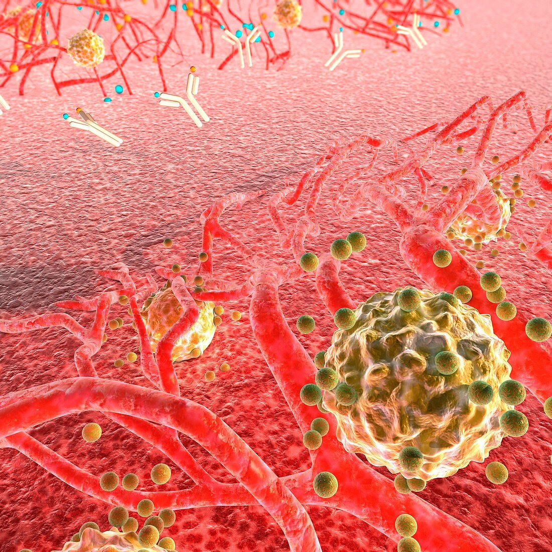 Antiangiogenic cancer treatment, illustration