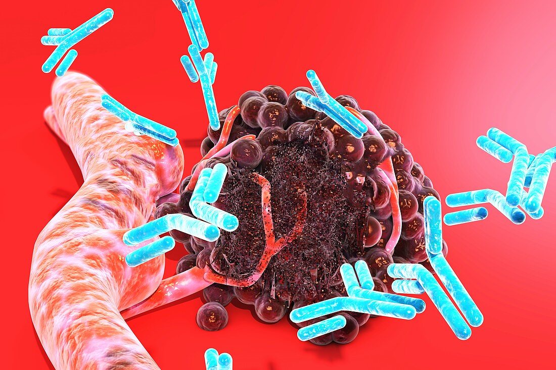 Antibodies attacking tumour, illustration