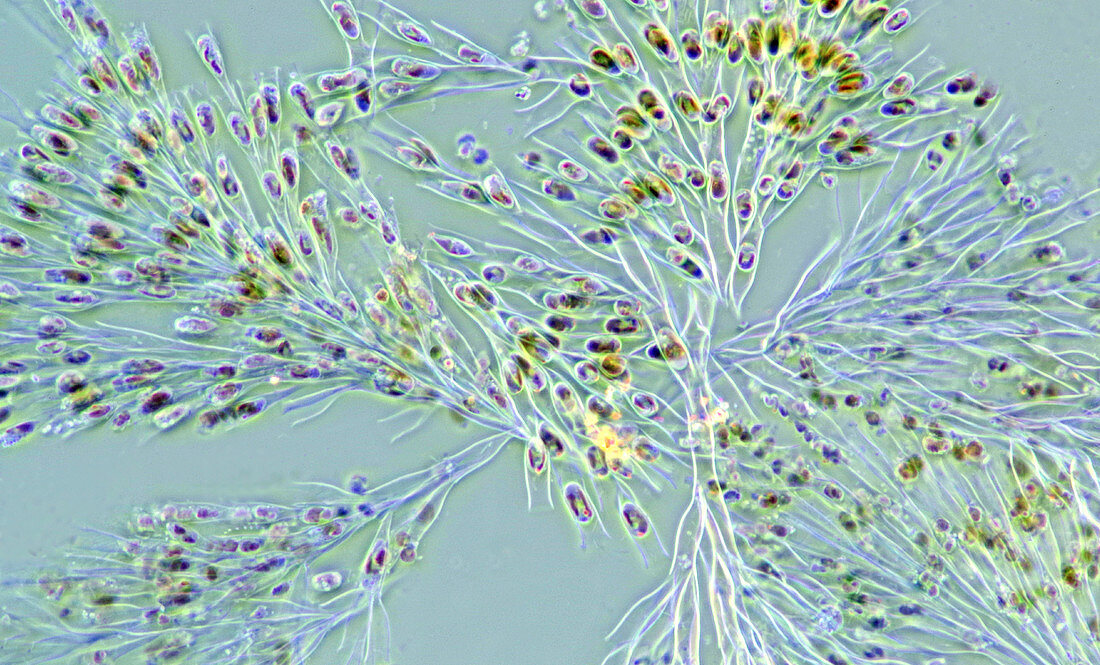 Dinobryon colonial algae, polarised light micrograph