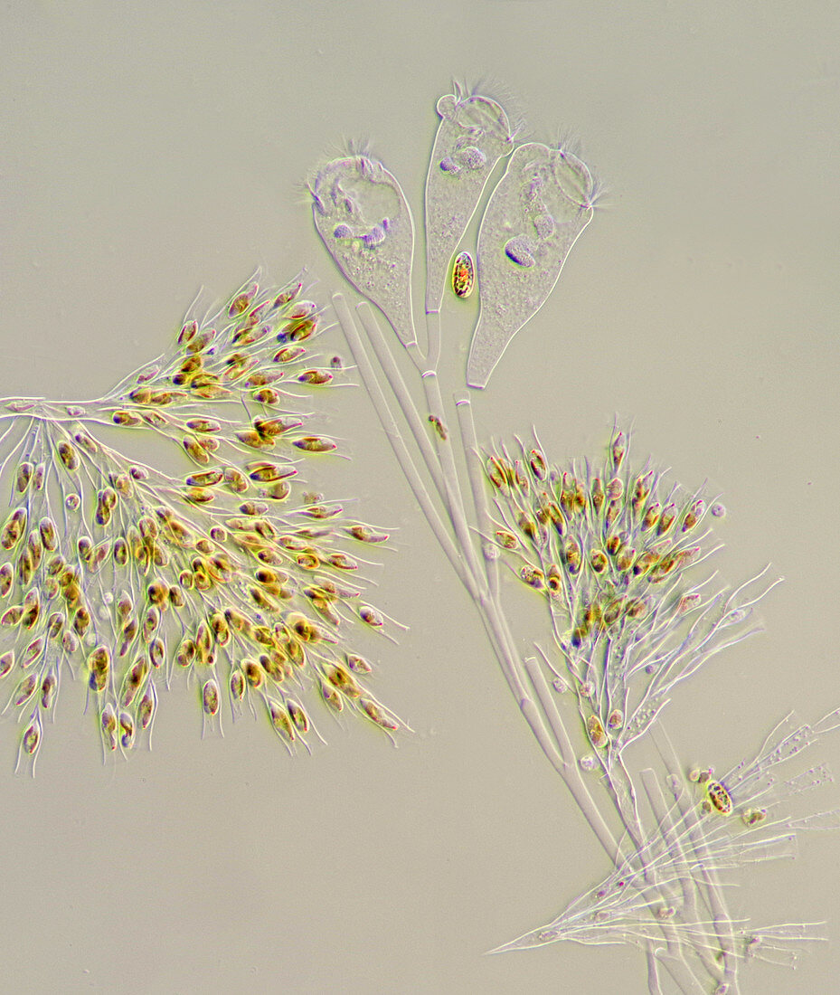 Dinobryon colonial algae, polarised light micrograph