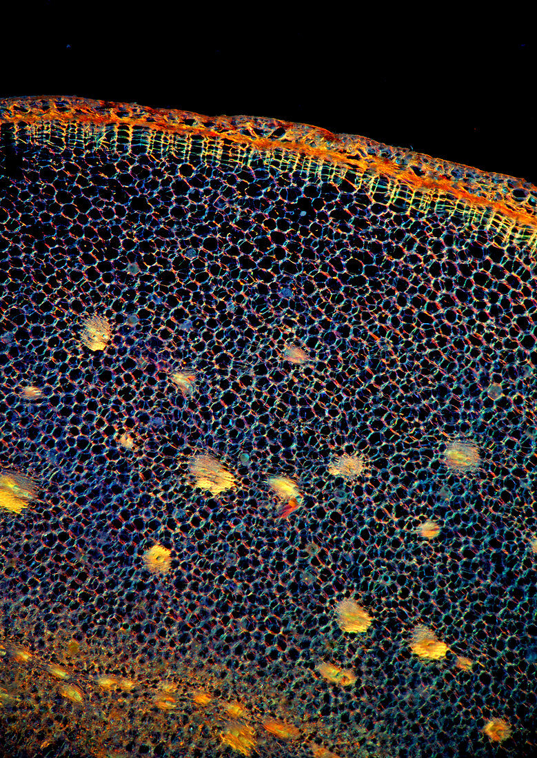 Ginger (Zingiber officinale) root, light micrograph