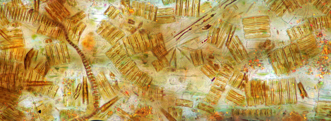 Tabellaria diatoms, polarised light micrograph