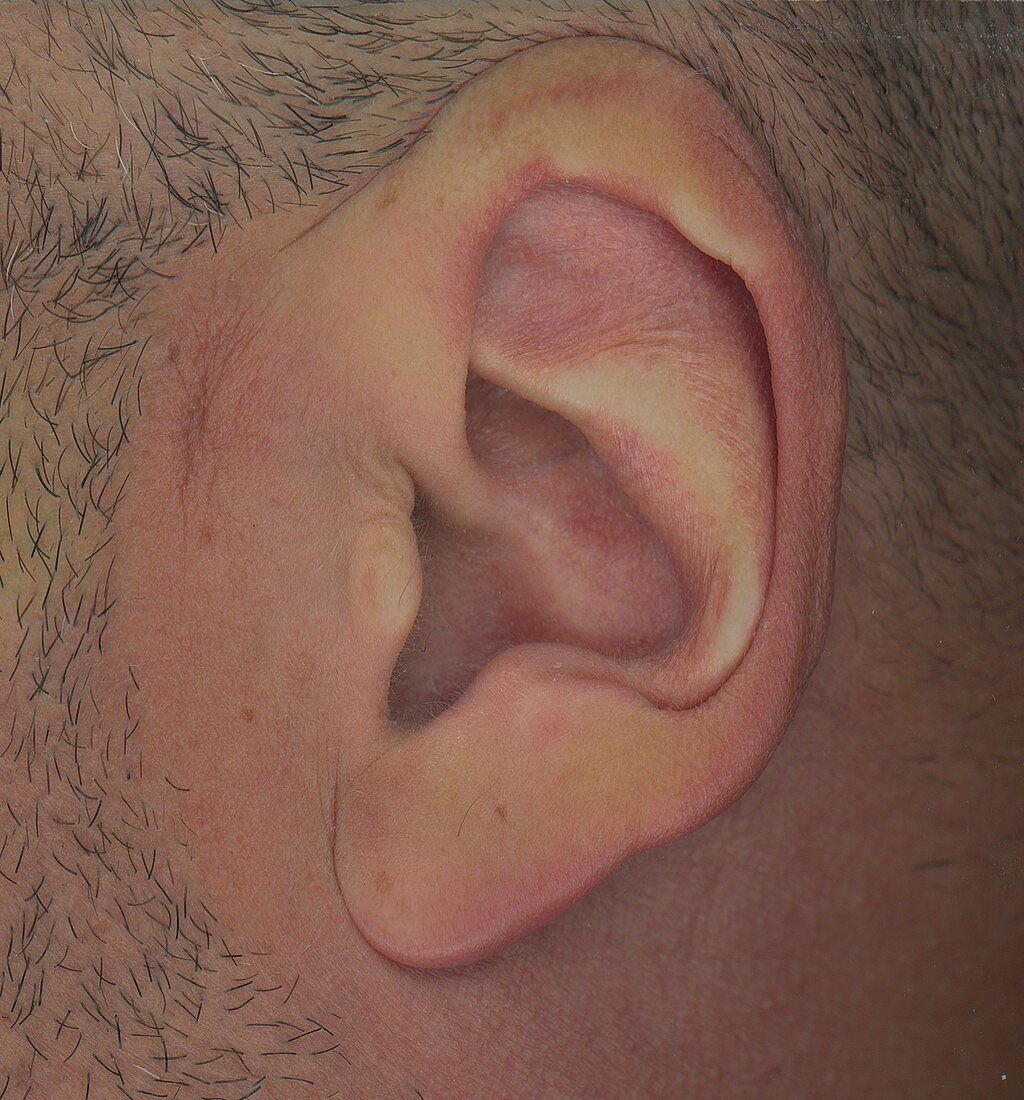Man's outer ear