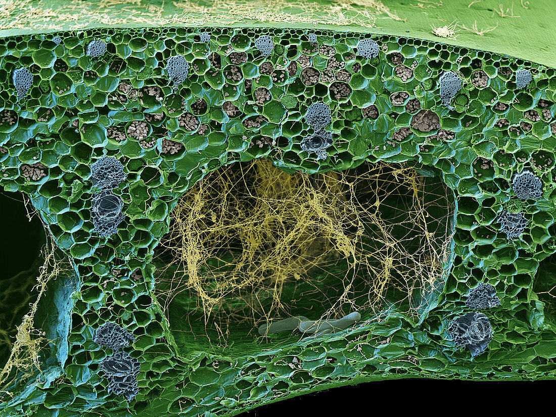 Panama disease pathogen in banana leaf, SEM