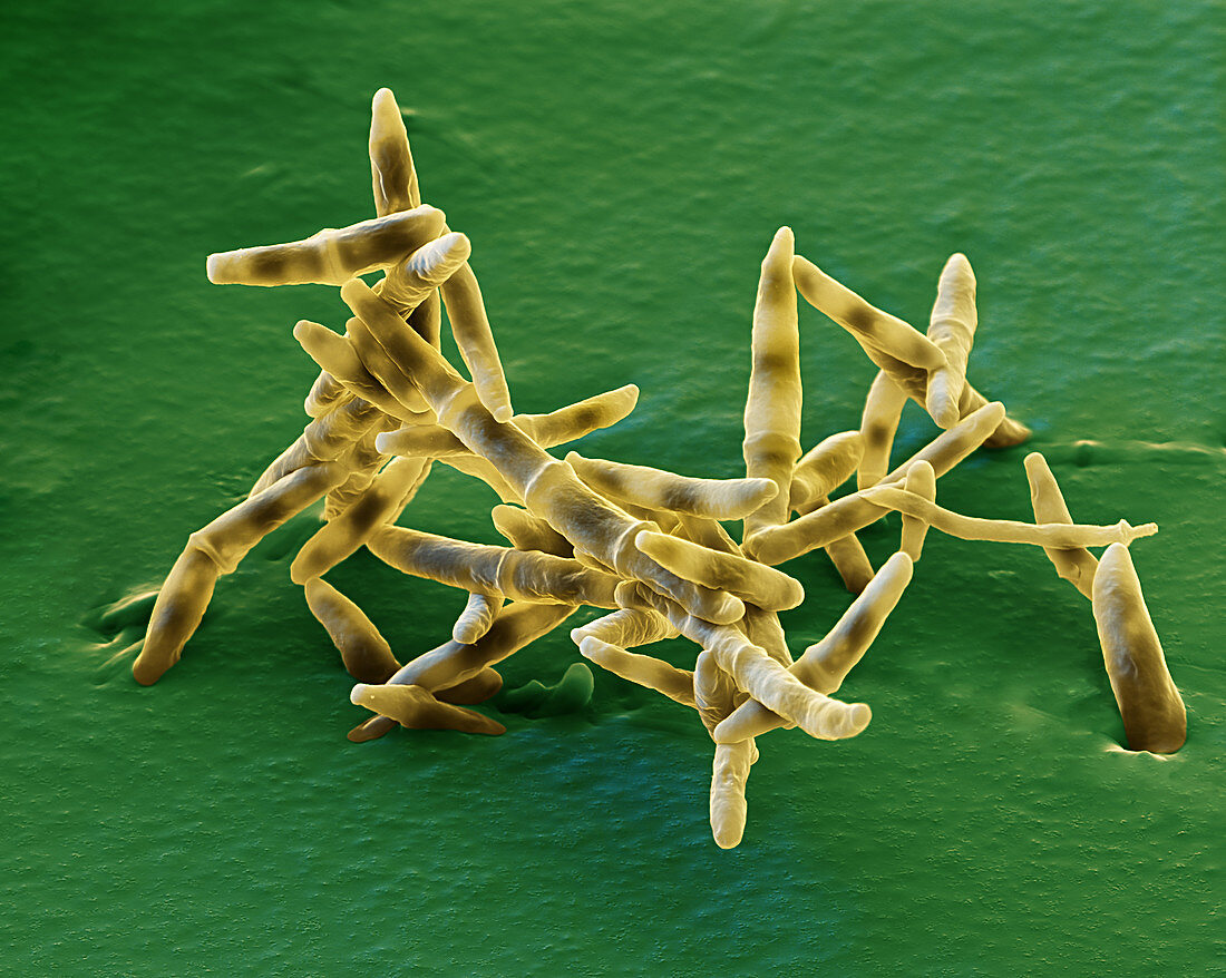 Panama disease fungus spores, SEM