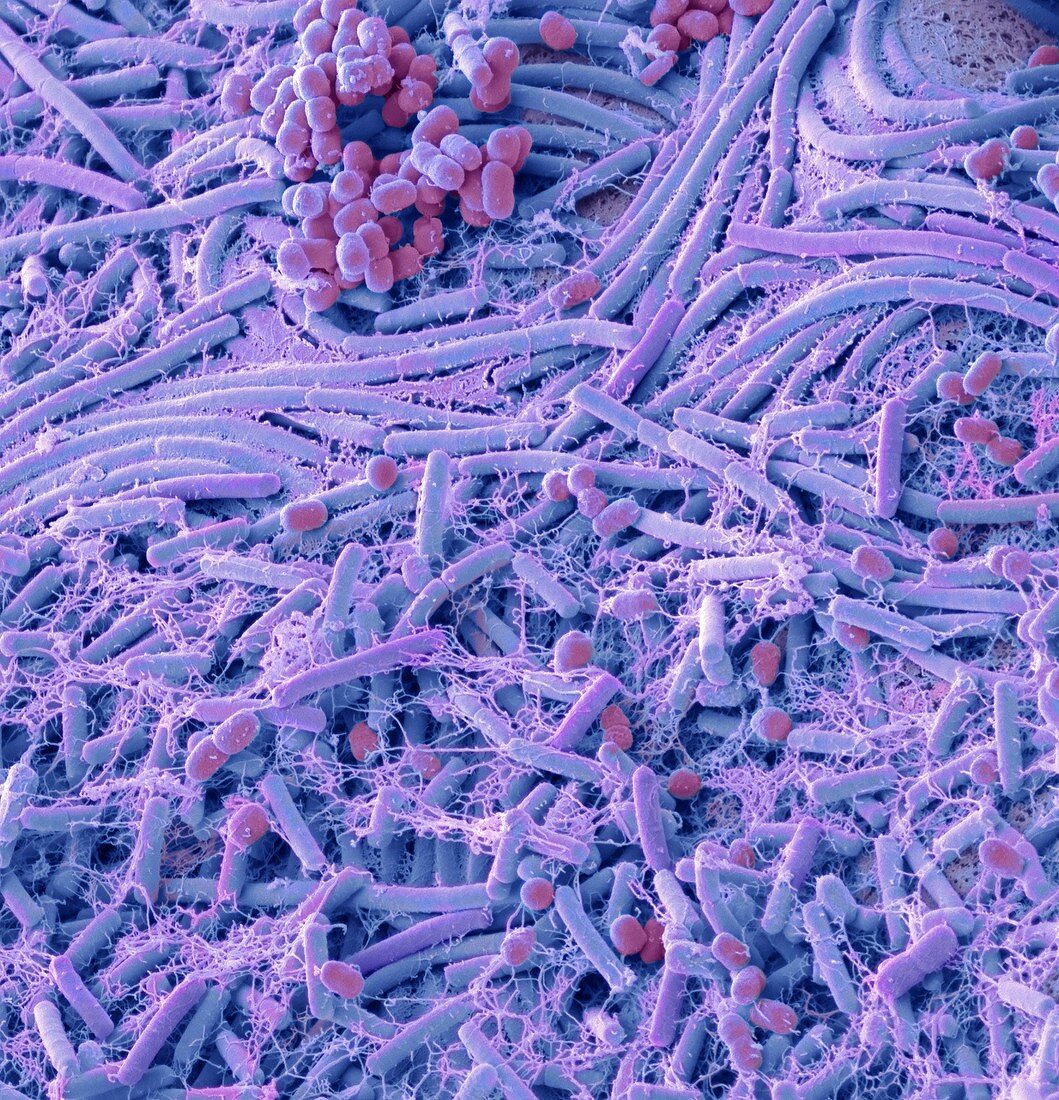 Bacteria from a coin, SEM