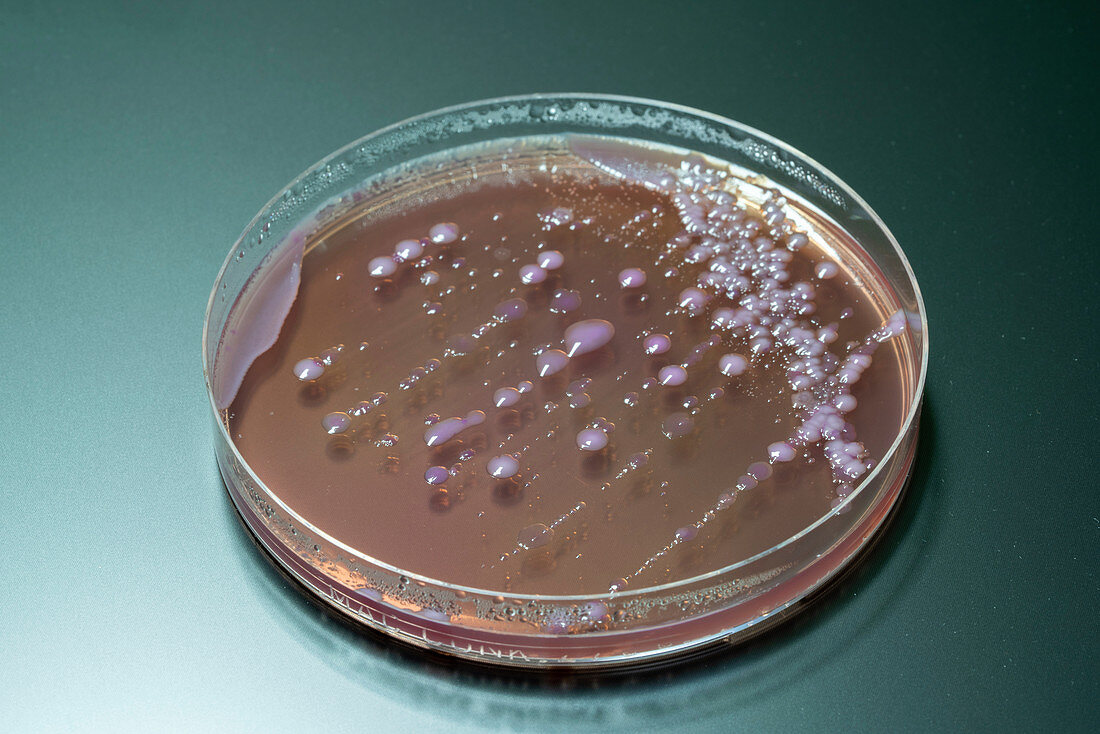Bacterial colonies on agar plate