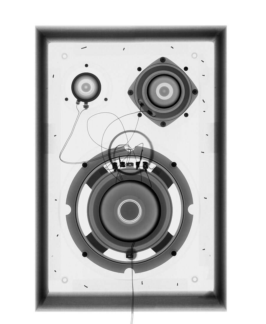 Speaker, X-ray