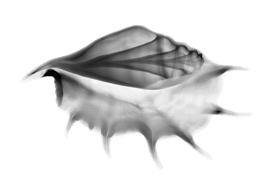 Conch shell, X-ray