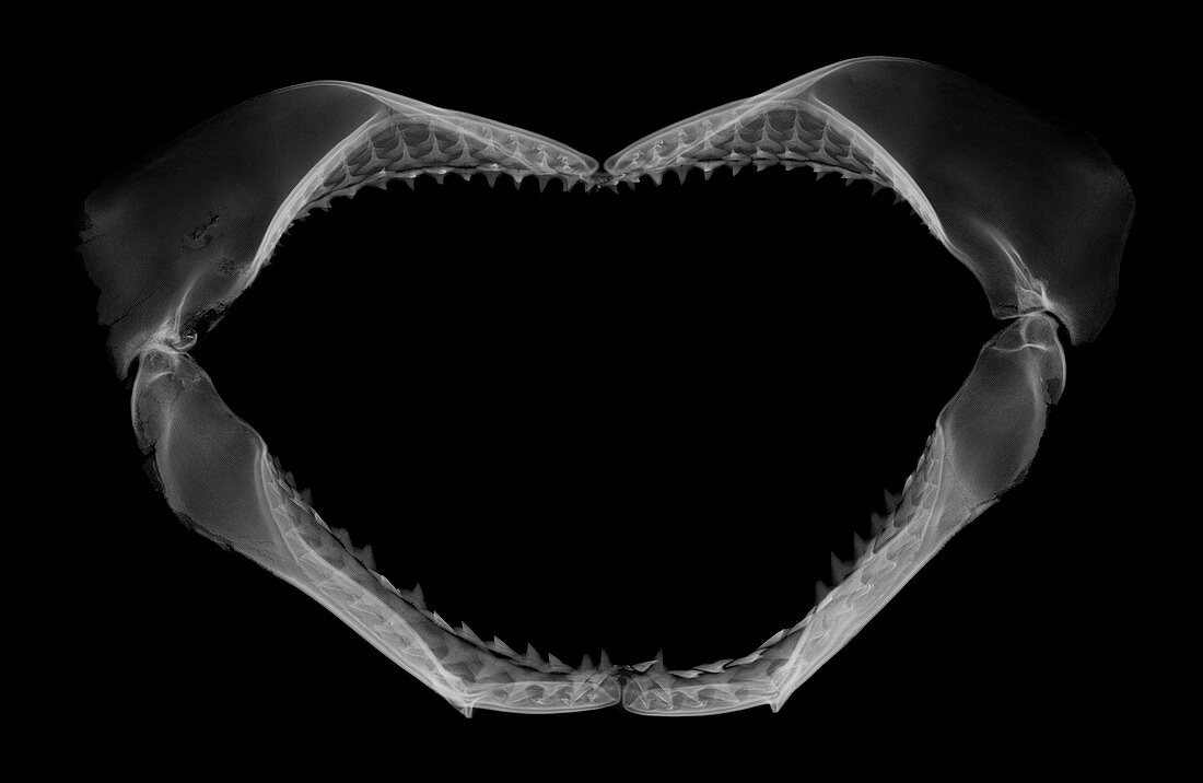 Shark jaw, X-ray