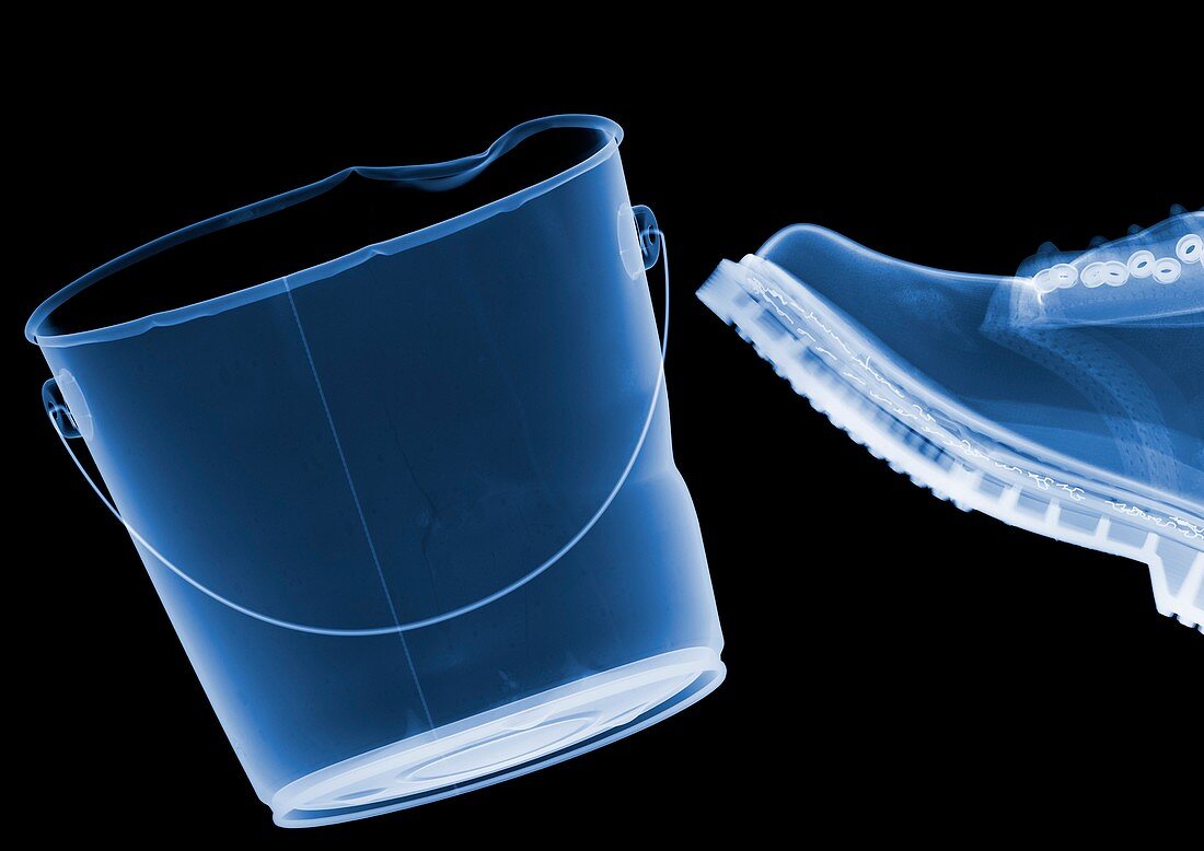 Boot kicking bucket, X-ray