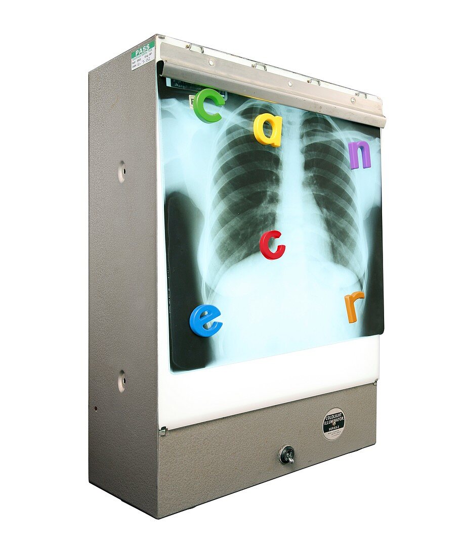 Alphabet letters on x-ray screen, X-ray