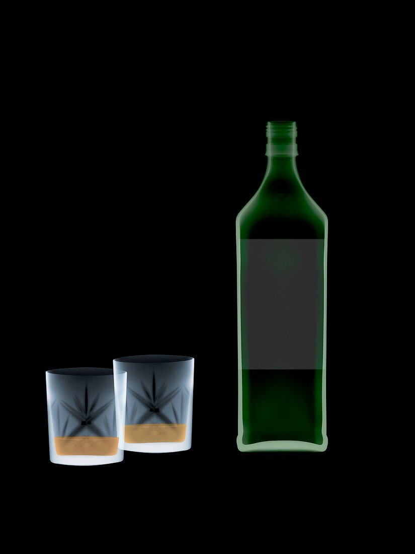Whiskey bottle and glasses, X-ray