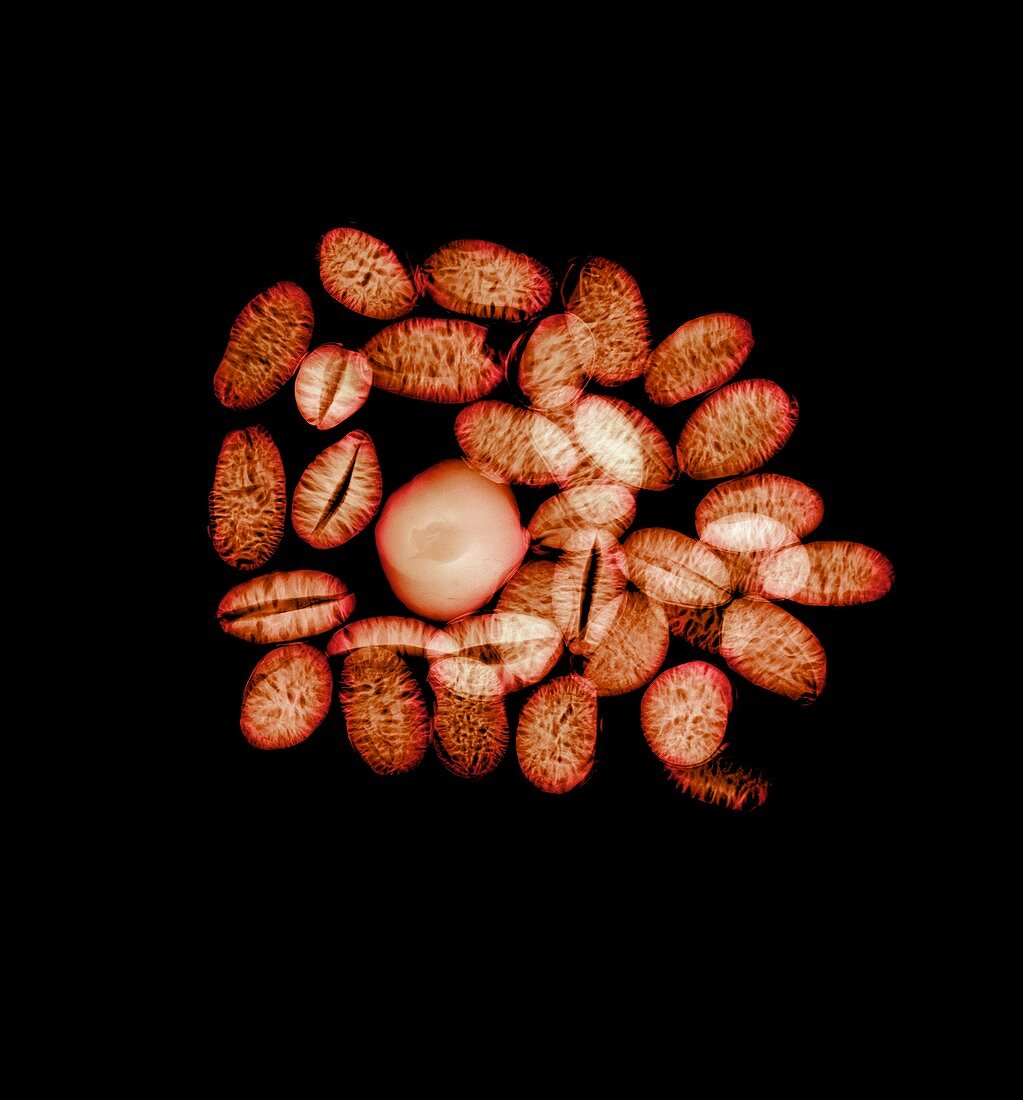 Common hazel and tiger nuts, X-ray