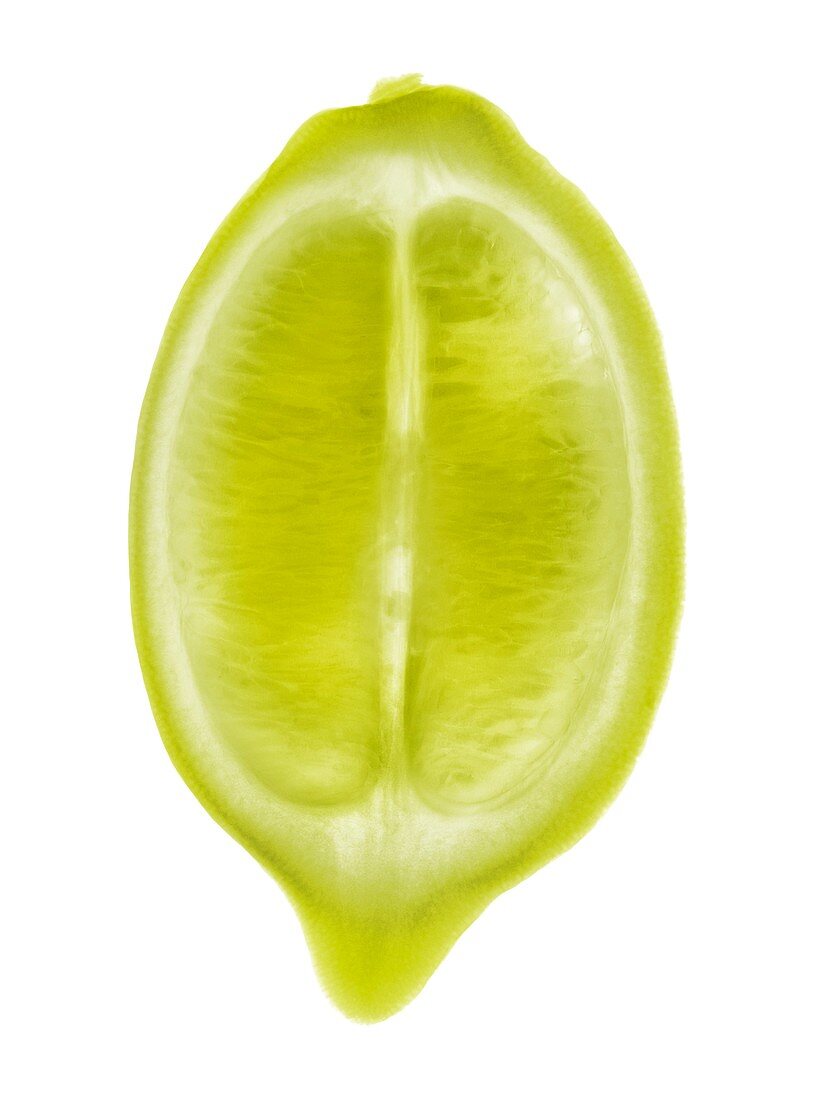 Lemon, X-ray