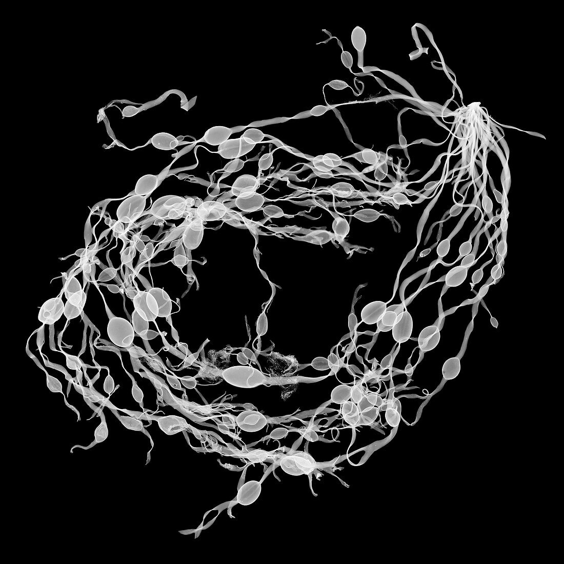 Bladderwrack seaweed (Fucus vesiculosus), X-ray