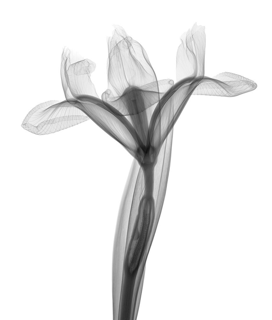 Iris, X-ray