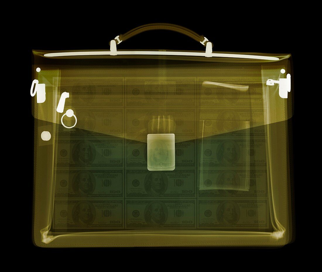 Case containing money, X-ray