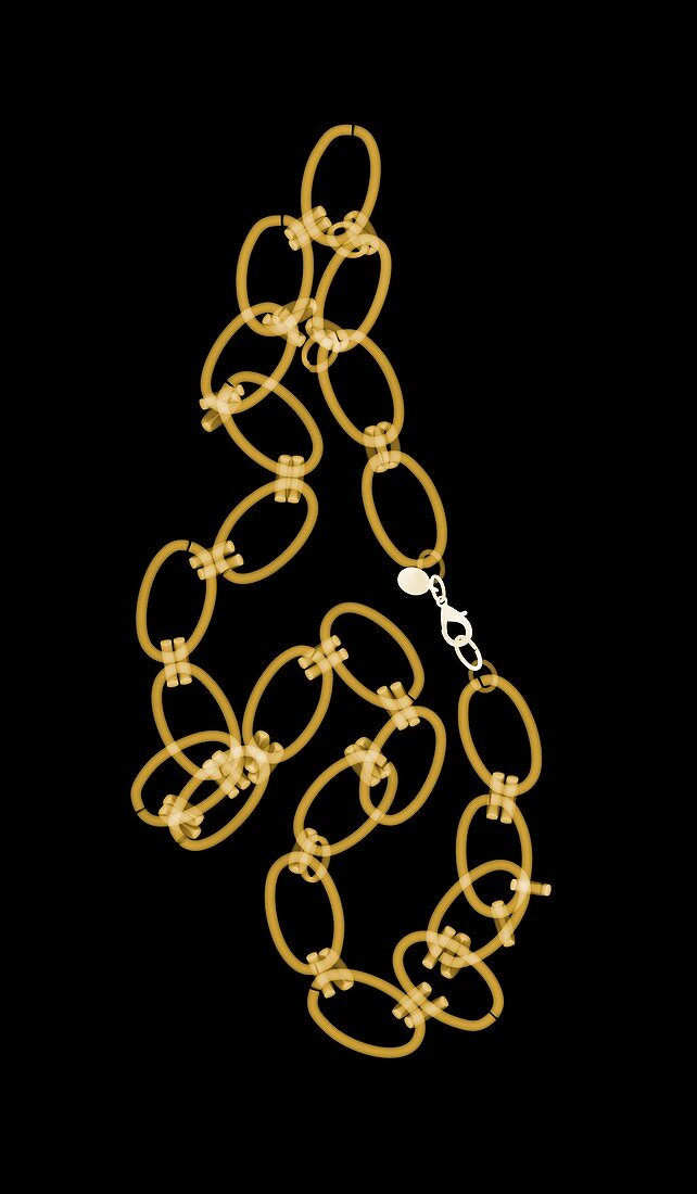 Chain necklace, X-ray