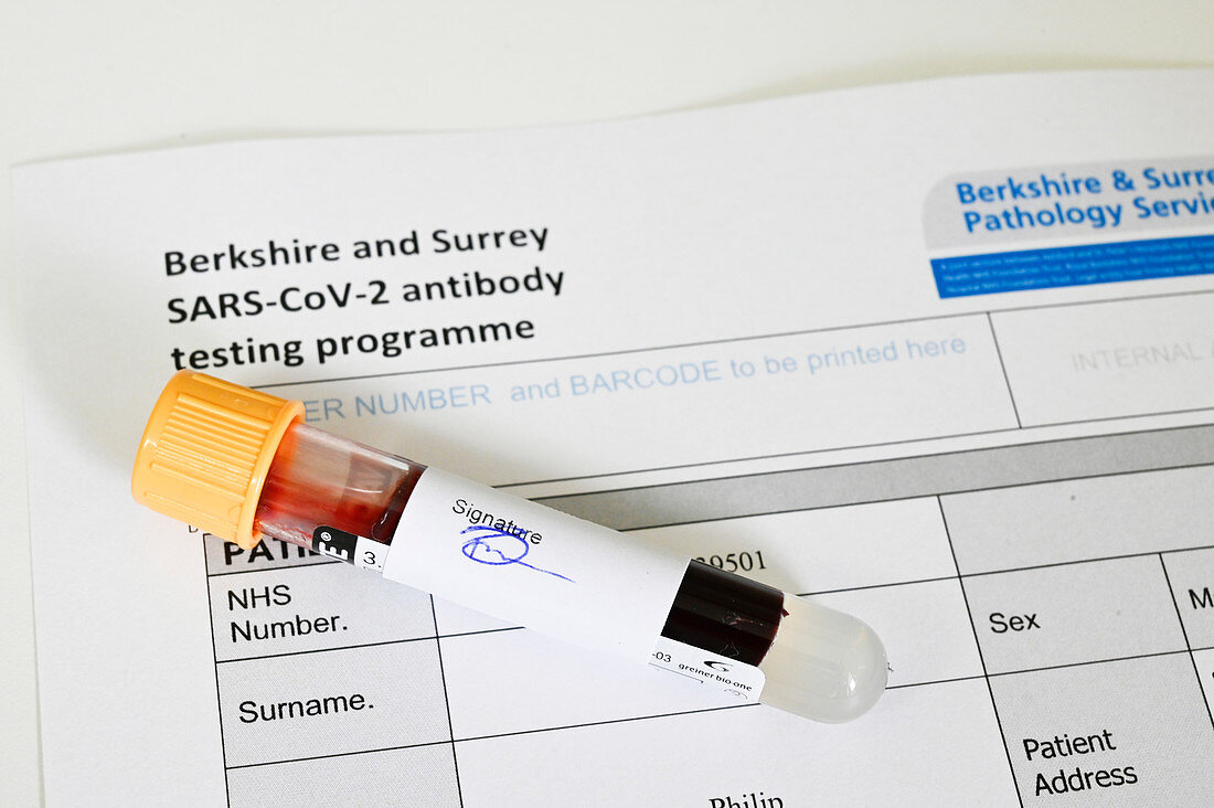Blood sample for Covid-19 antibody test