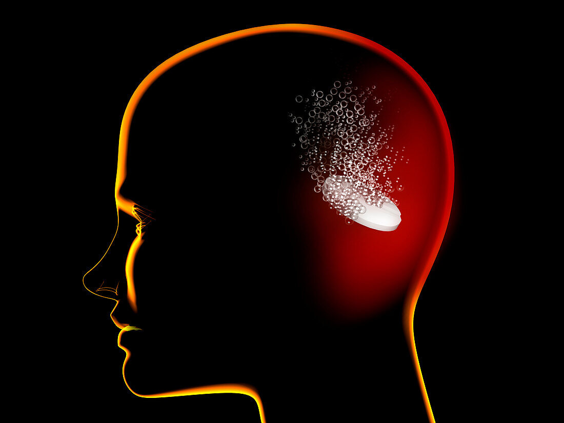 Headache treatment, conceptual illustration