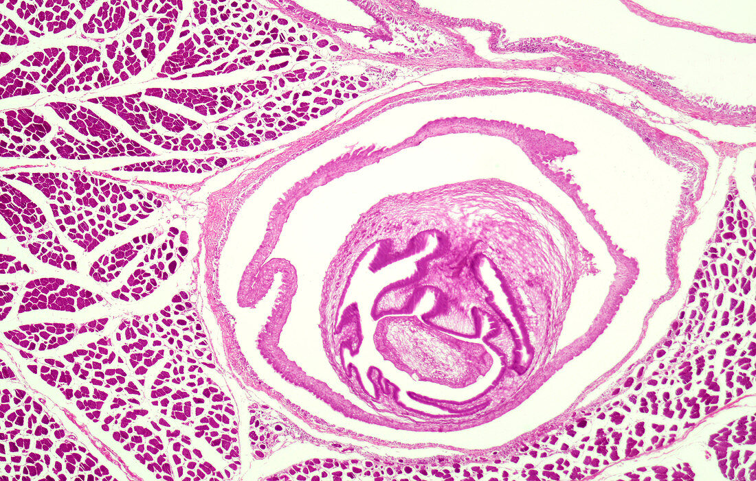 Cysticercus in pig muscle, light micrograph