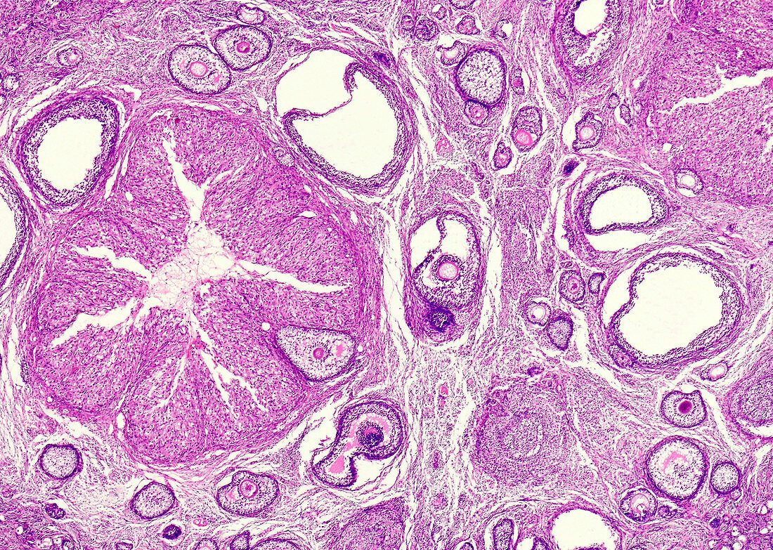 Graafian follicles in a mature ovary, light micrograph