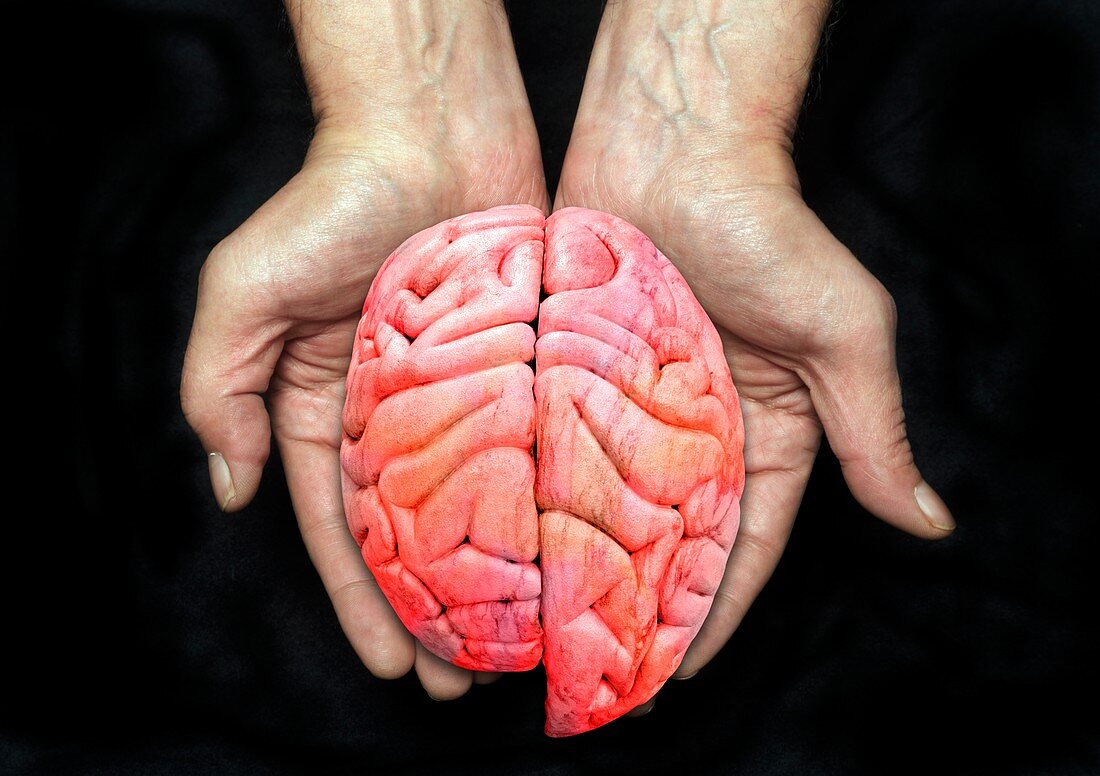 Enlarged left cerebral hemisphere, conceptual image
