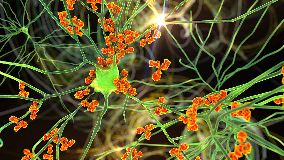 Antibodies attacking neurons, conceptual illustration