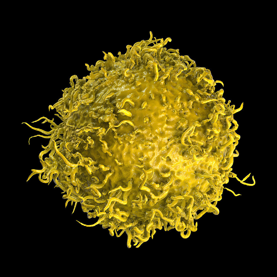 Stomach cancer cell, illustration