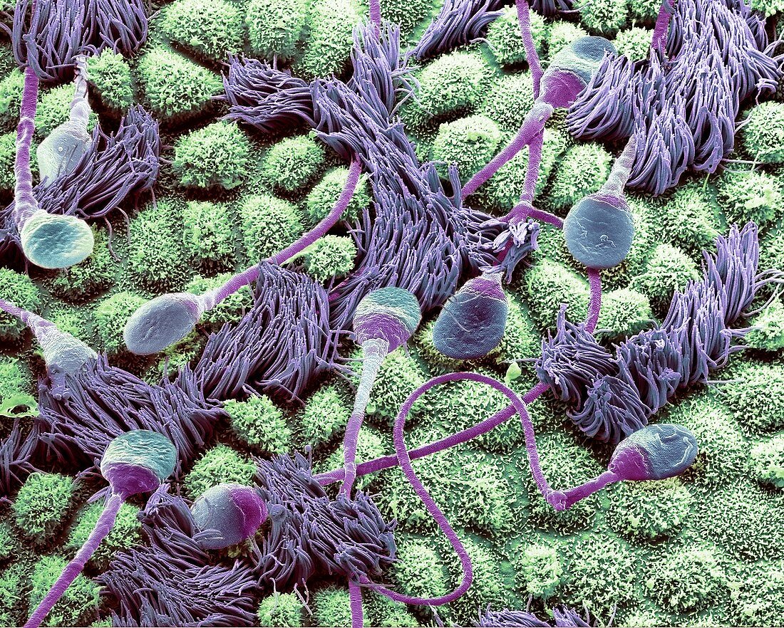 Sperm in a fallopian tube, SEM