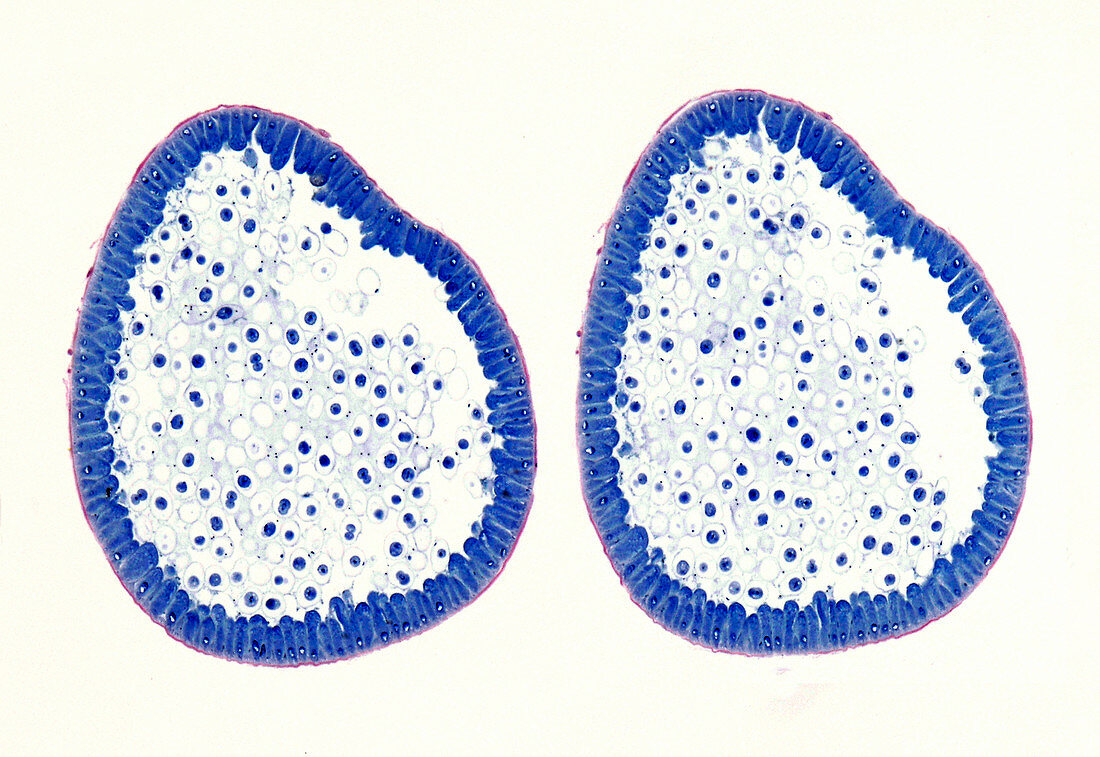 Giant roundworm eggs, light micrograph