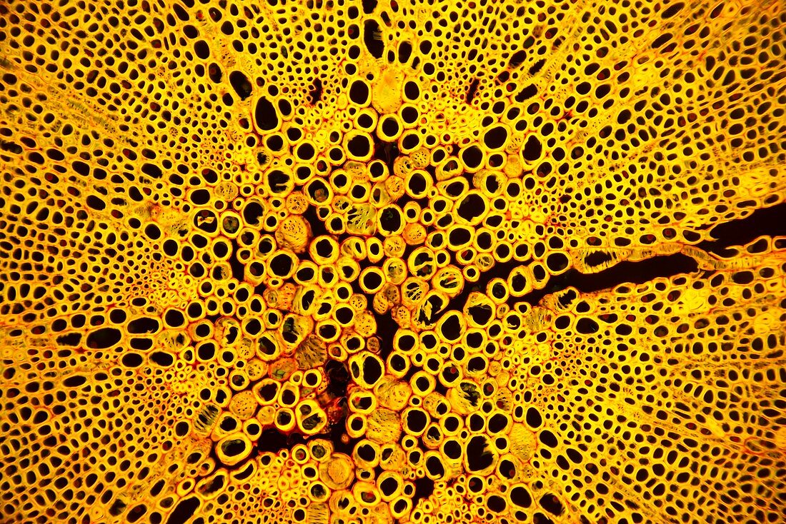 Casuarina tree, fluorescent light micrograph