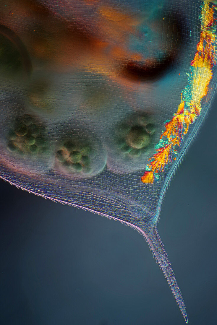 Daphnia water flea with embryos, light micrograph