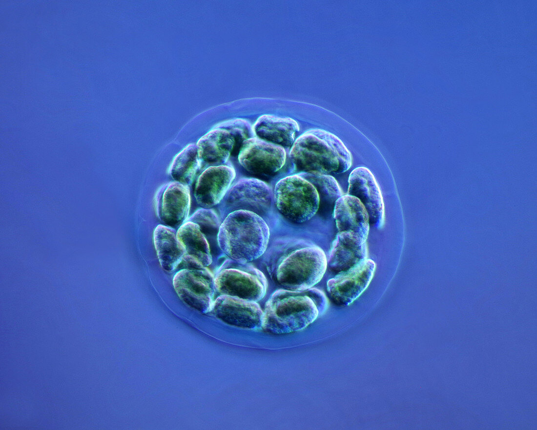 Eudorina algal colony, light micrograph
