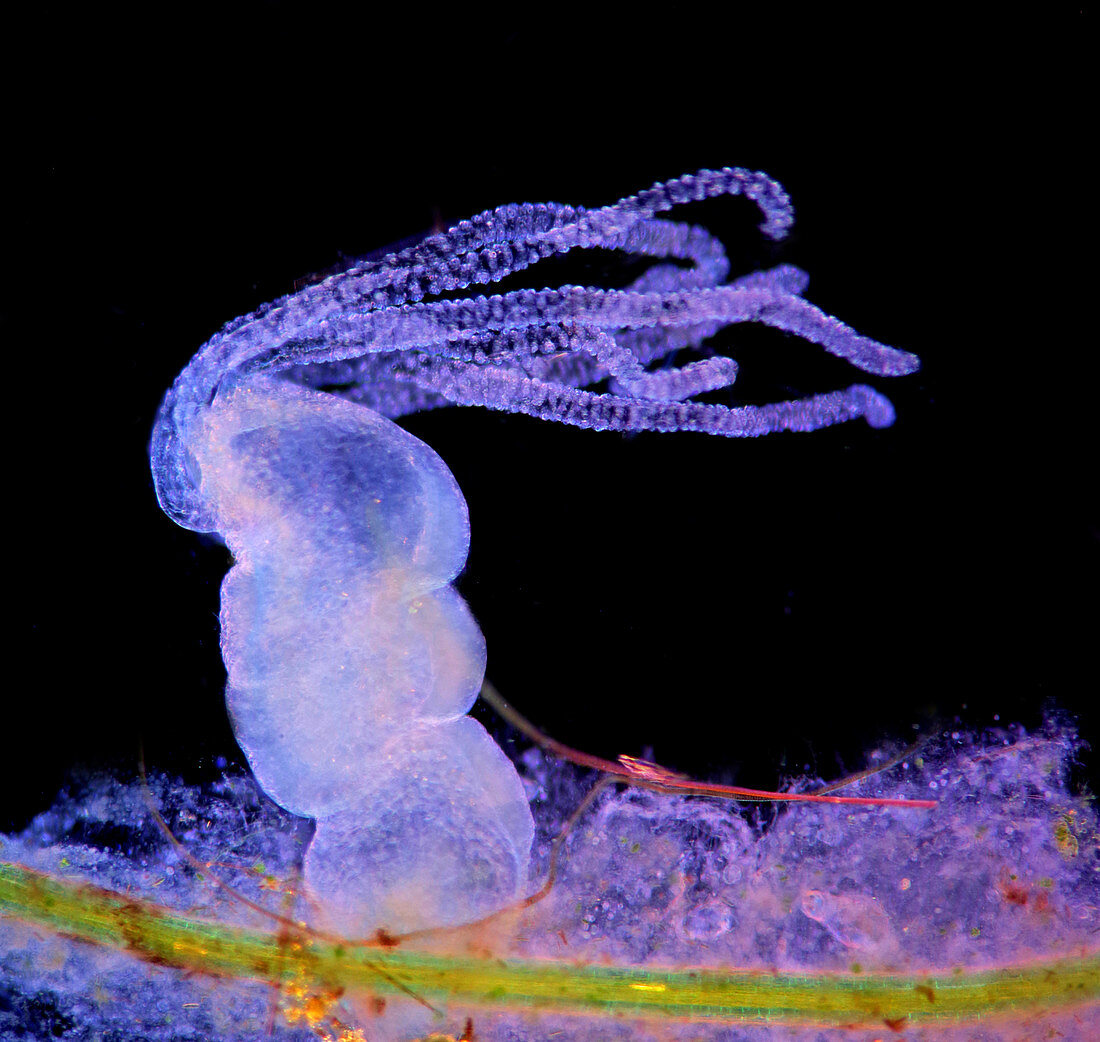 Hydra, polarised light micrograph