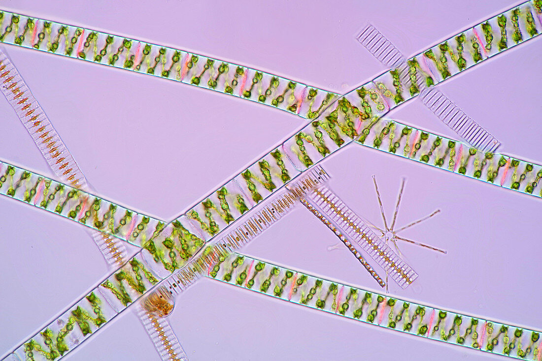 Diatoms and algae, polarised light micrograph