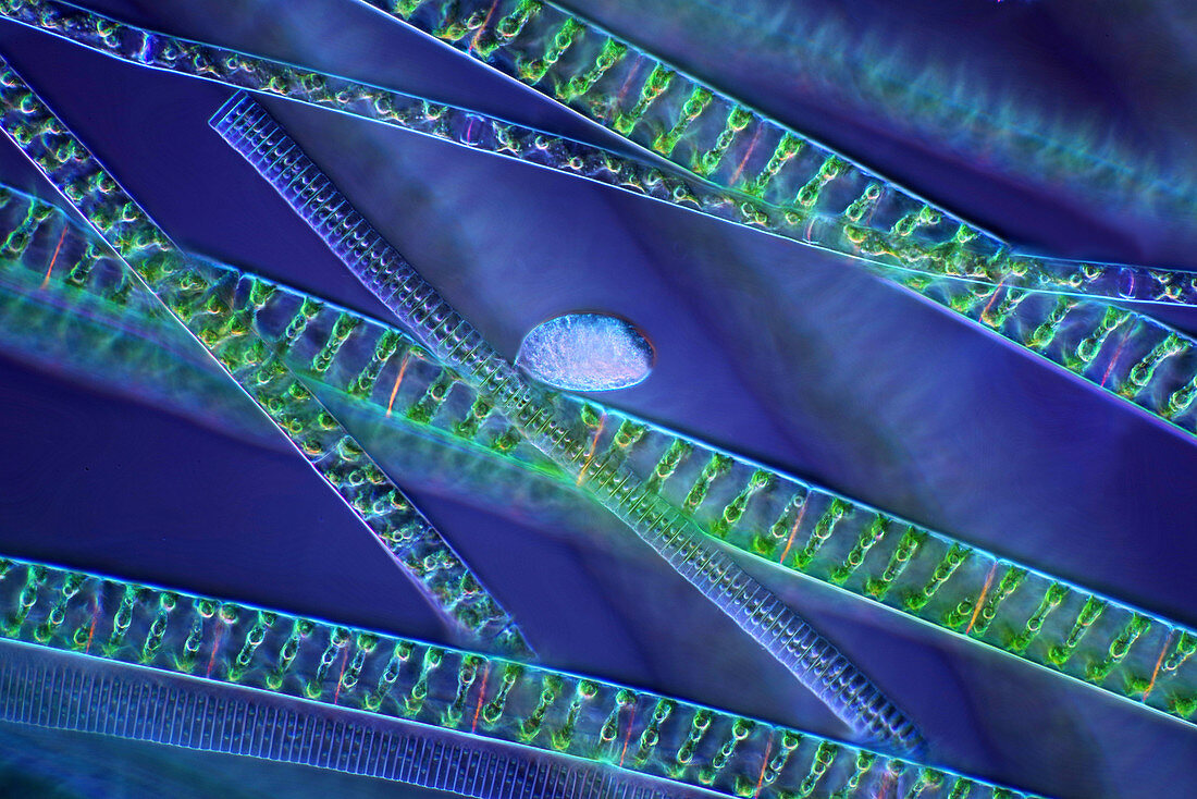 Diatoms and algae, polarised light micrograph