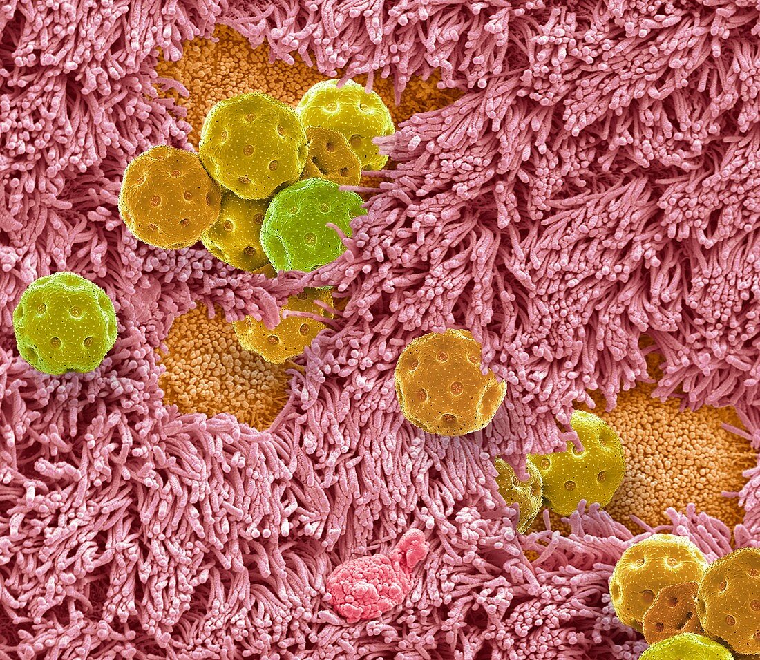Nasal epithelium and pollen, SEM