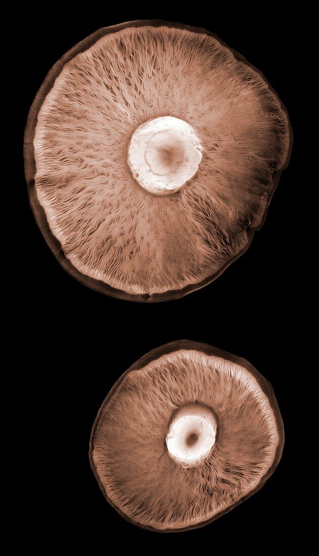Mushrooms, X-ray