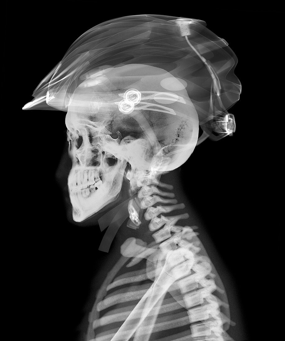 Skull and helmet, X-ray